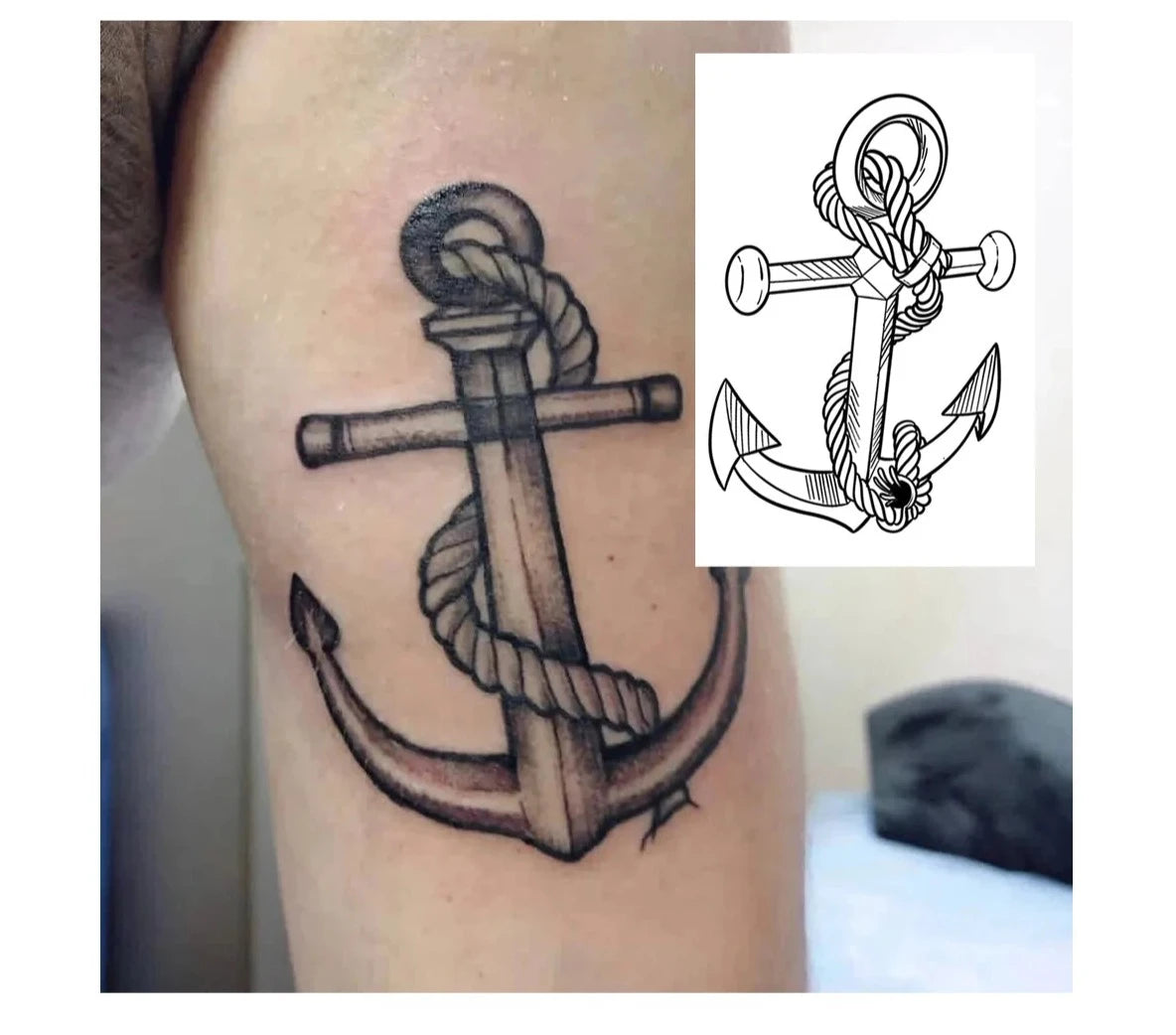 Anchor